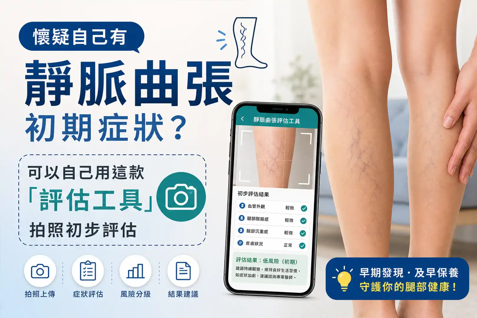 靜脈曲張評估工具